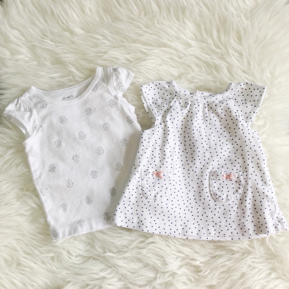 2Pack White Patterned Tops